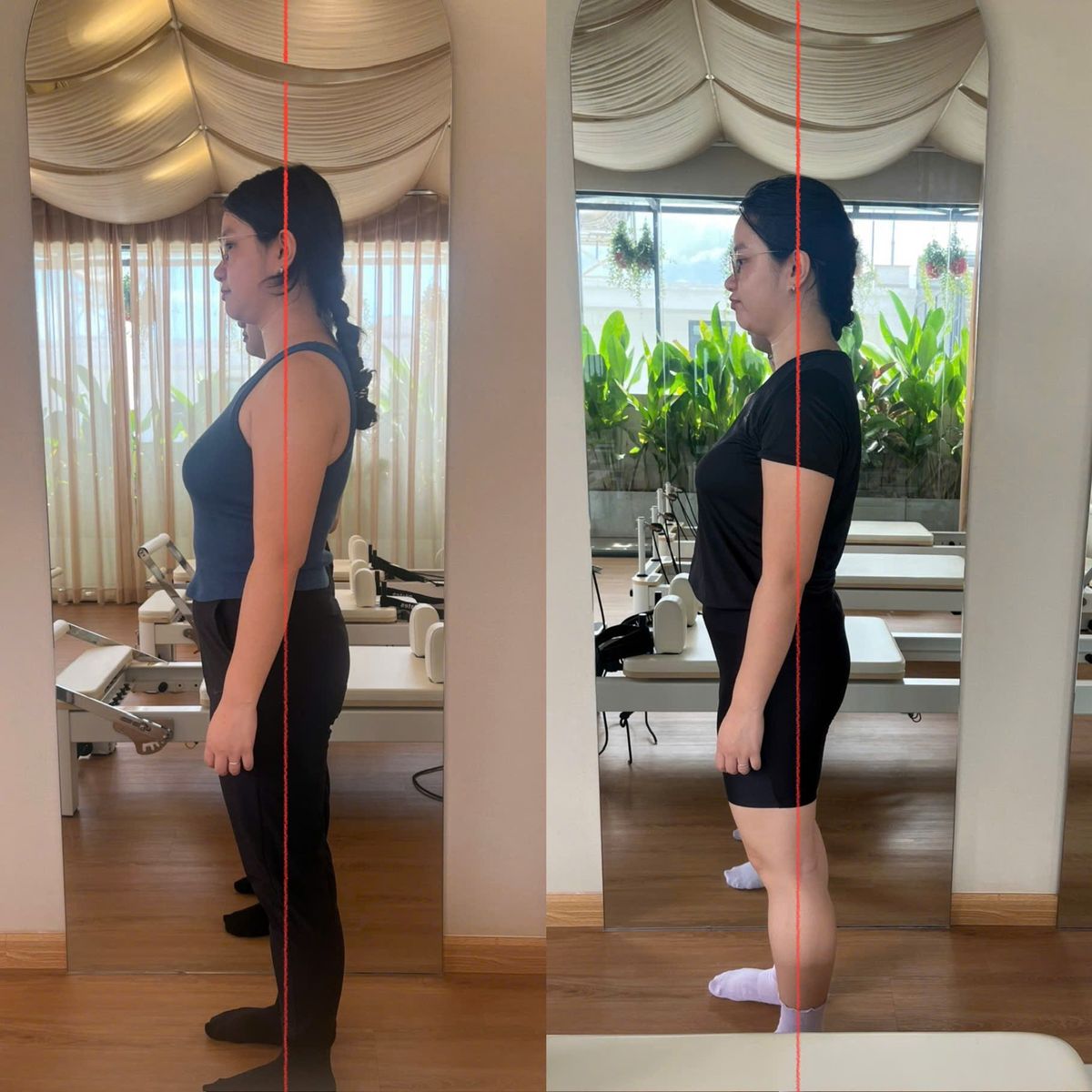 Before-and-after Body Check photos of a KHI student