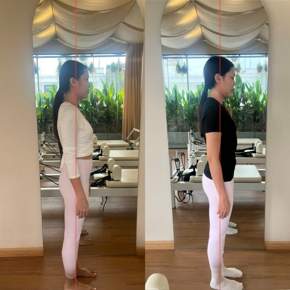 Before-and-after Body Check photos of a KHI student